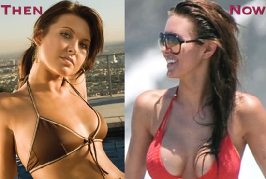 Audrina-Patridge-before-and-after-boob-photo